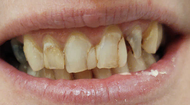 Before - Cosmetic Enhancement